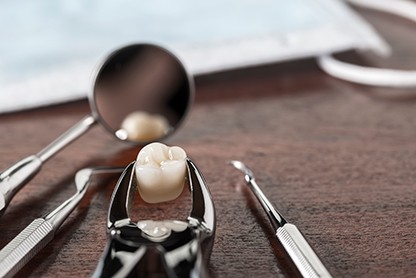 Your dentist may offer options for making your tooth extraction more affordable