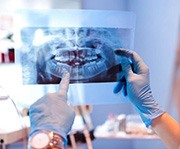 Oral surgeon in Alexandria holding an X-ray