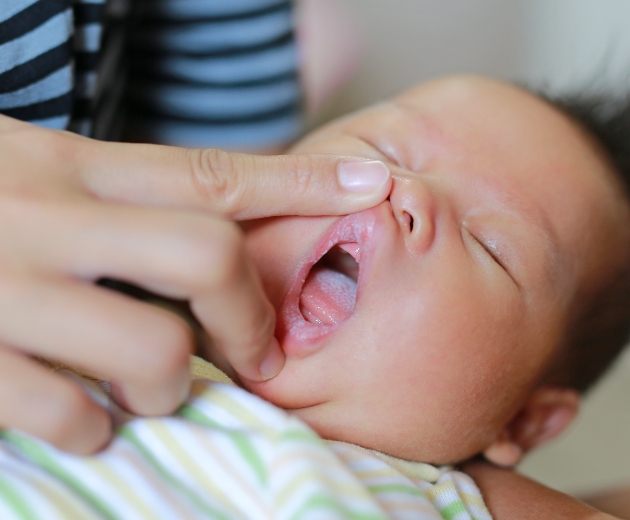 Oral surgeon examining infant before frenectomy