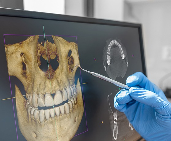 Scan of patient’s teeth and jaws on computer monitor