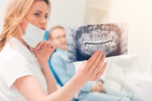 Patient and dentist examining an X-ray of mouth.