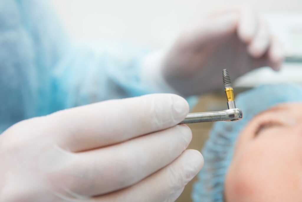 An oral surgeon holding a dental implant during dental implant surgery.
